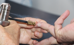 Rastreio gratuito do cancro da pele regressa ao concelho de Alcoutim