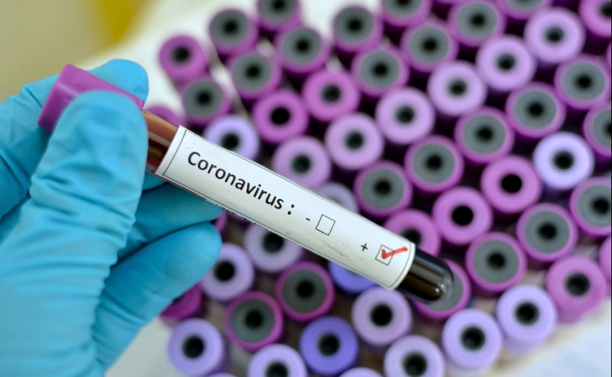 Covid-19: Hoje registam-se mais 25 casos de infetados no Algarve