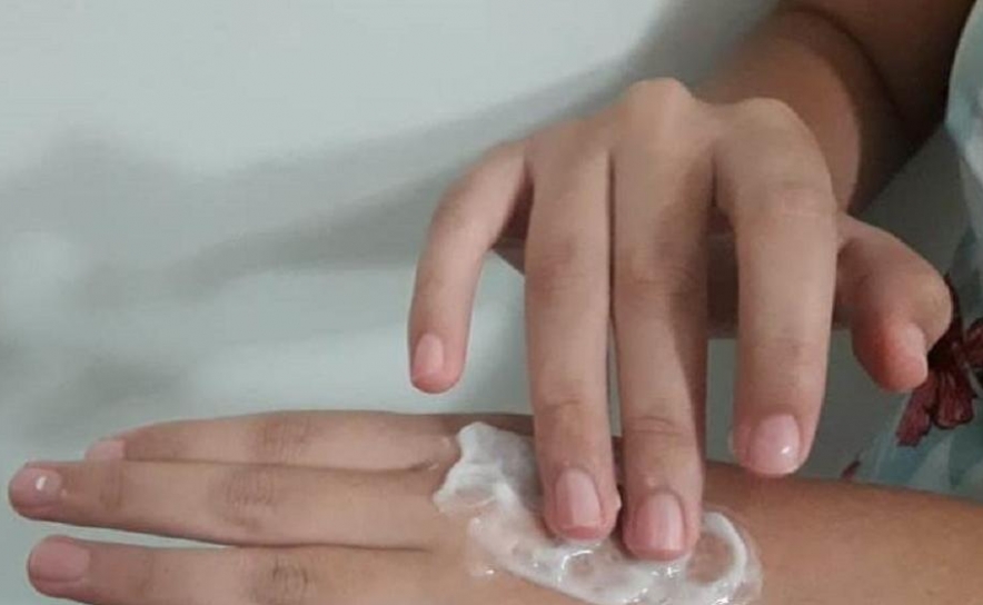Dermatologistas alertam que é preciso hidratar as mãos depois de desinfetar