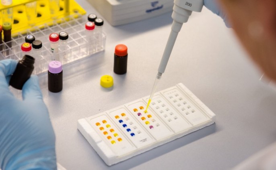 Covid-19: Cientistas portugueses criam teste de diagnóstico rápido a partir da saliva