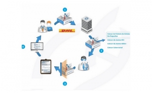 OncoDNA lança OncoSELECT, um estudo específico para doentes com cancro do pulmão, cólon e mama