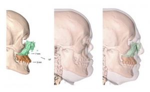 Cirurgia Inédita em Portugal 