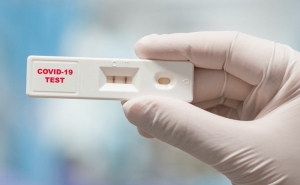 Covid-19: Câmara de Lagoa disponibiliza testes gratuitos à população e funcionários