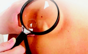 Castro Marim rastreia doenças da pele depois da época balnear