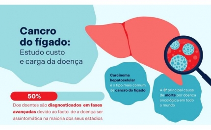 Cancro do fígado vai roubar cerca de 6.600 vidas em cinco anos, estima estudo nacional