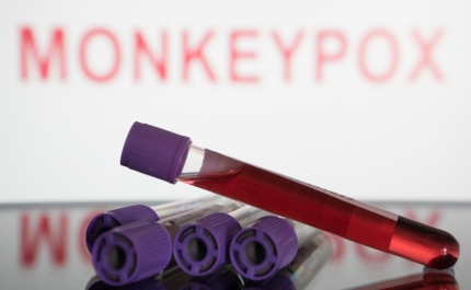 Monkeypox: Número de casos sobe para 373
