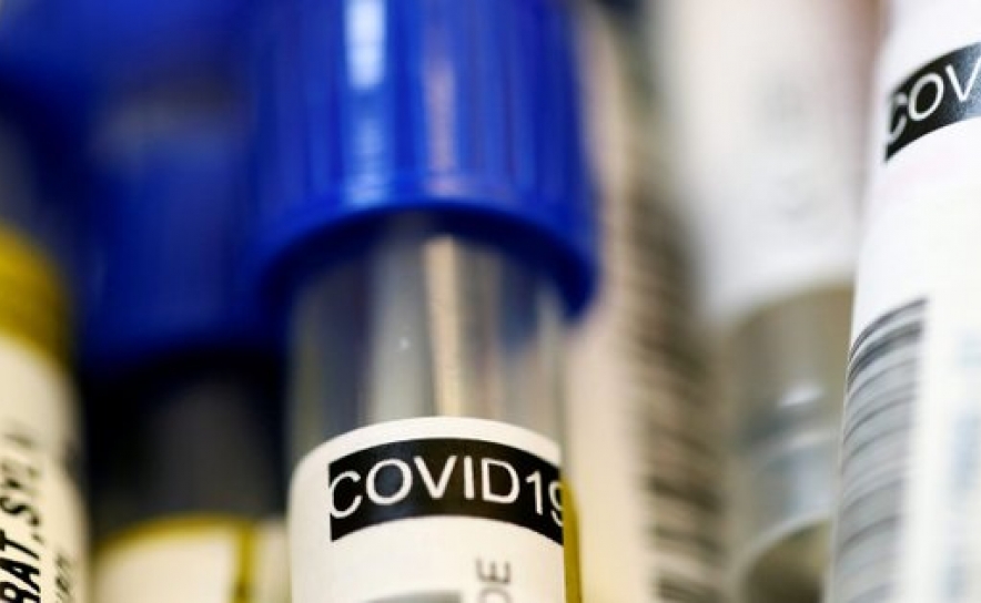 Covid-19: Investigadores portugueses estudam potencial vacina oral