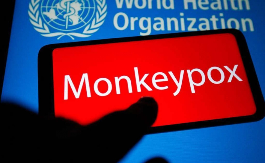 Monkeypox: Portugal ultrapassara os 400 casos