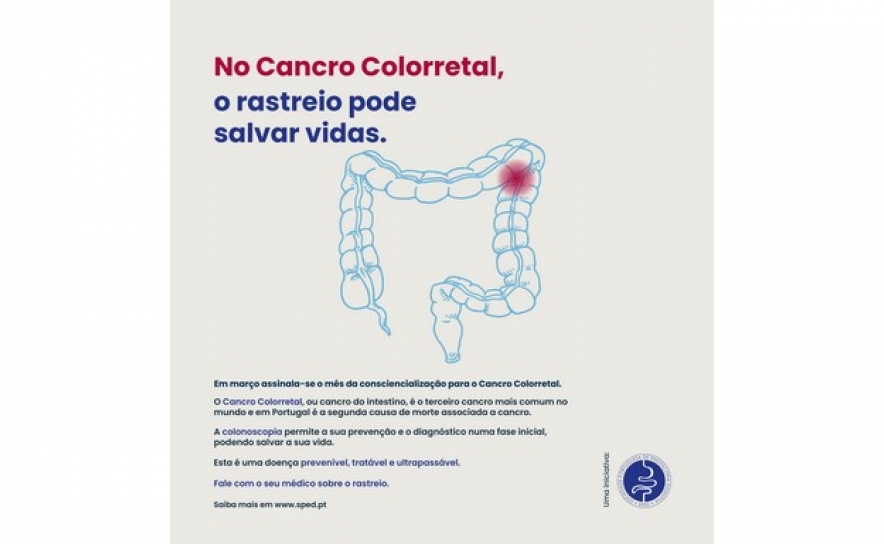 Médicos alertam para a importância do diagnóstico precoce do Cancro Colorretal 