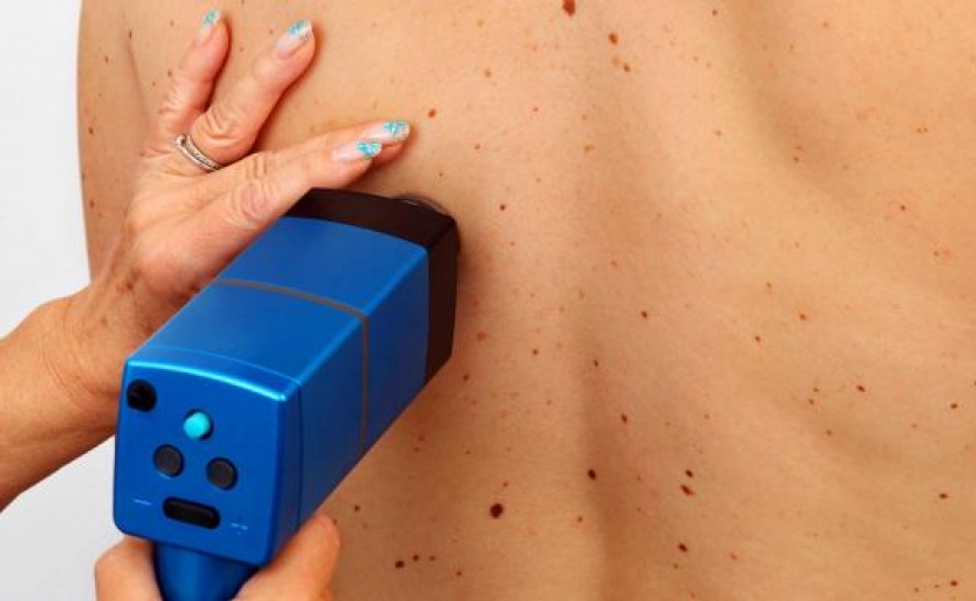 Tavira Gran-Plaza participa em ação de sensibilização - Melanoma