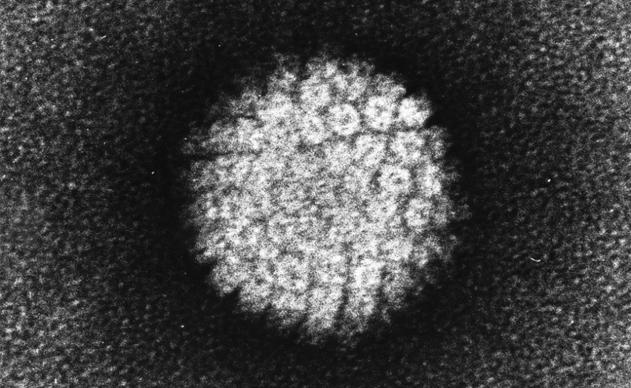 «Mulheres com rastreios positivos para o HPV devem ter uma vigilância clínica mais regular»