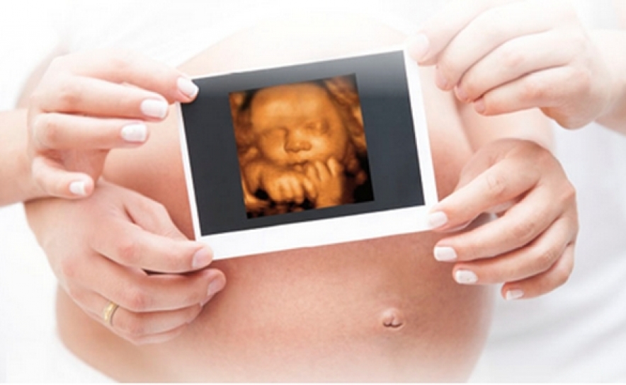 Ecografias emocionais 3D/4D gratuitas