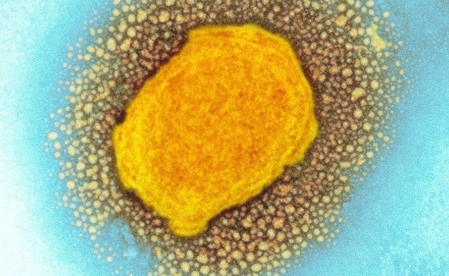 Monkeypox: 191 casos confirmados em Portugal